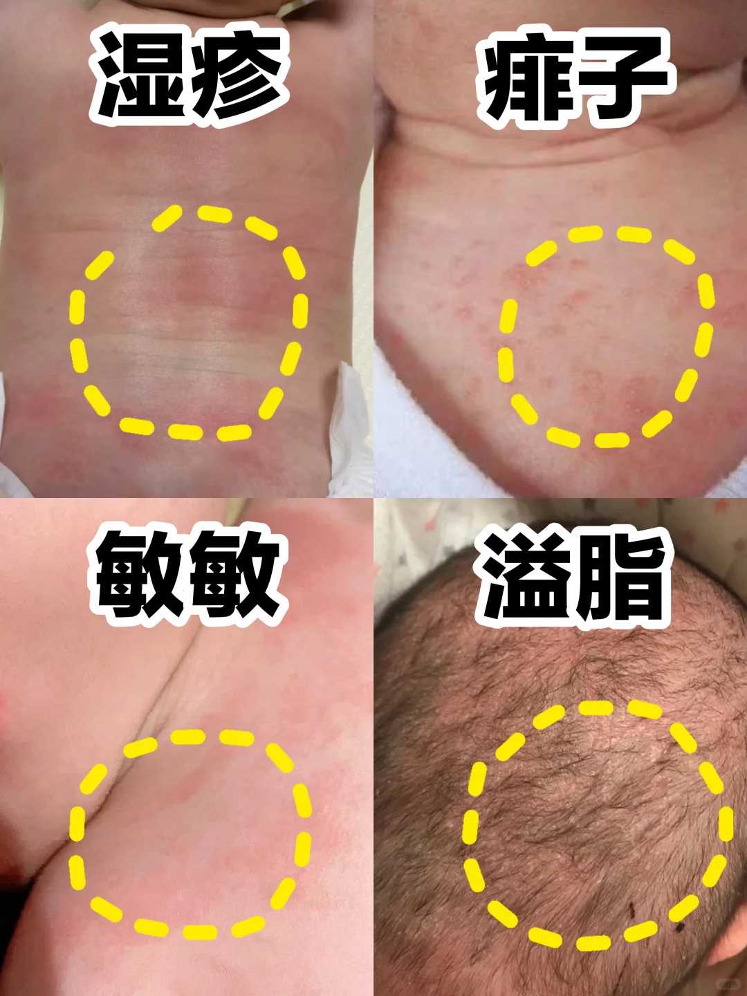 三个月大的宝宝出现腹泻症状,家长该如何应对?