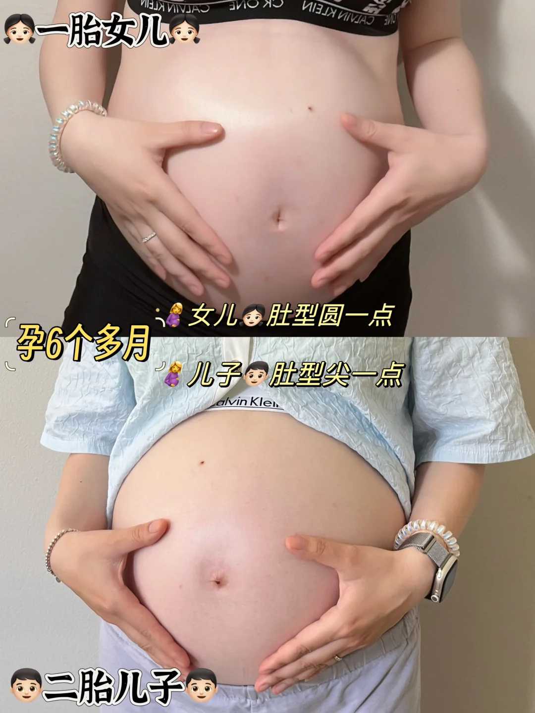 国内借卵试管中心+专业试管代孕哪里有,单角子宫影响胚胎着床吗?试管做男女