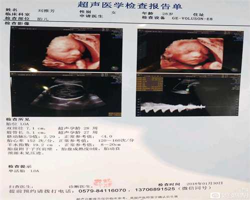 女性代代孕间可以运动吗代孕适合那些运动_北京