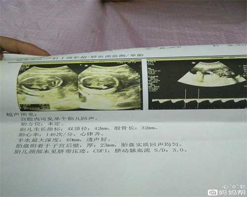 能到生孩子：代孕后多久，女人可以做B超检查也
