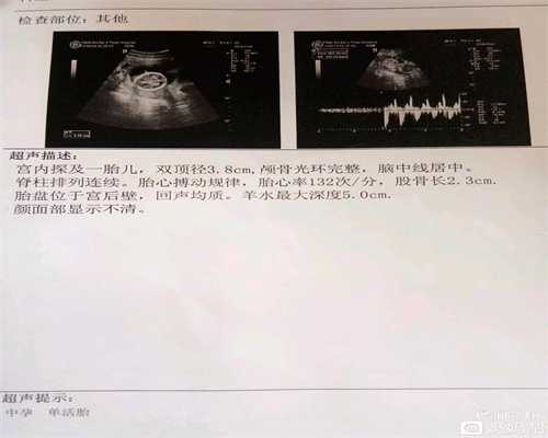 做完X线辐射检查后发现代孕了，胎儿要不要留