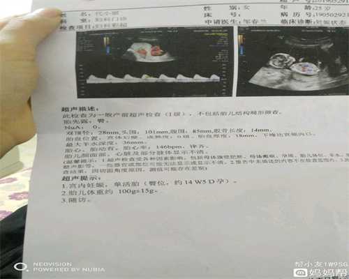 助孕妈产前检查预防胎宝宝畸形_代孕初期注意事