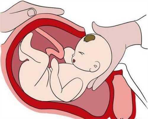 没吃叶酸就代孕了，会不会影响胎儿健康