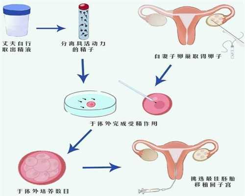 代孕好能定期做产前检查