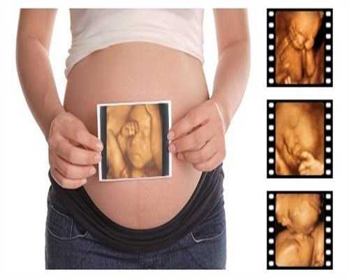 助孕妈一定要注意的几个胎教注意事项