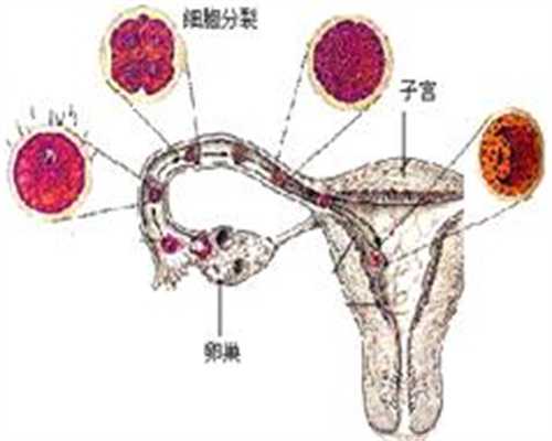 关于妊娠纹的相关知识