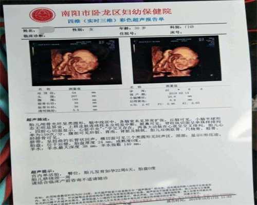 代孕做B超检查的注意事项_重庆医院大全