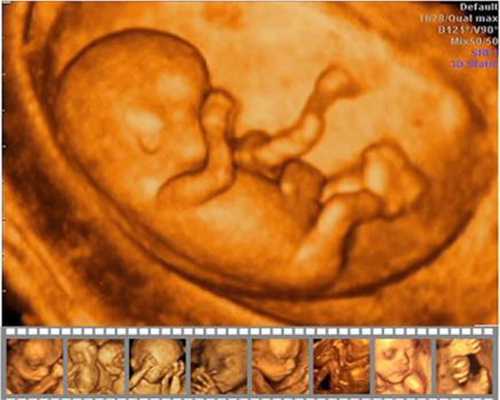 代孕保健：代孕八件事最伤害胎儿_怎么生孩子方