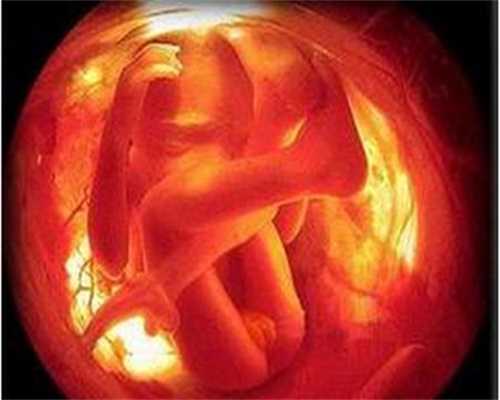 代孕保健：代孕八件事最伤害胎儿_怎么生孩子方